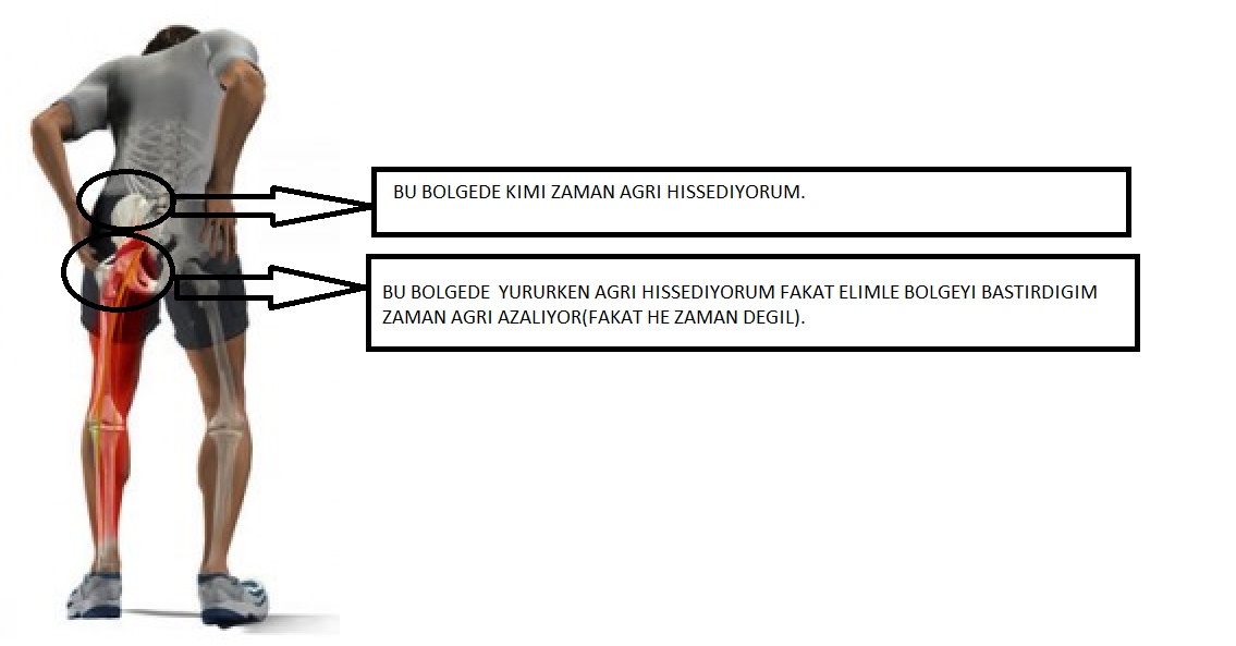 kalça-ağrısı-157x300.jpg