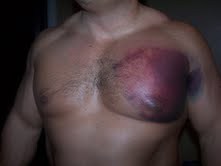 pec1.jpg